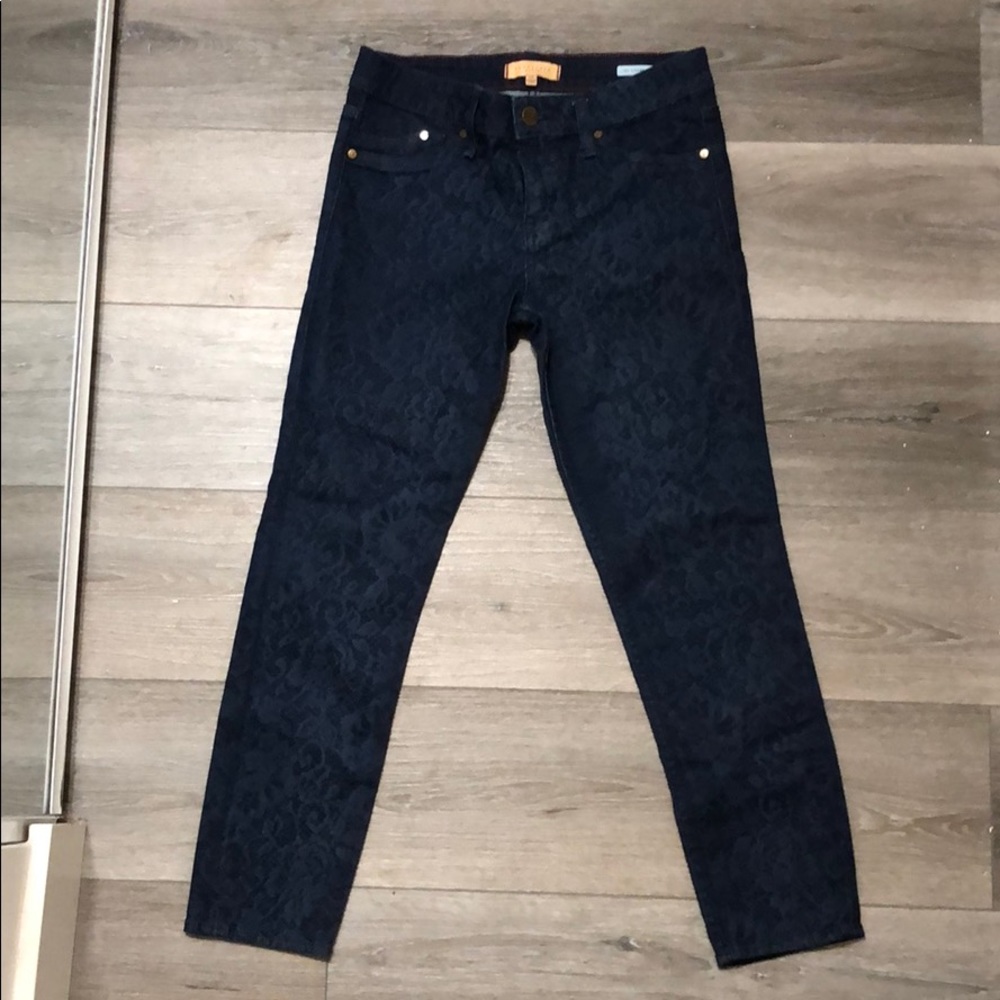 Sanctuary Ankle length skinny jeans